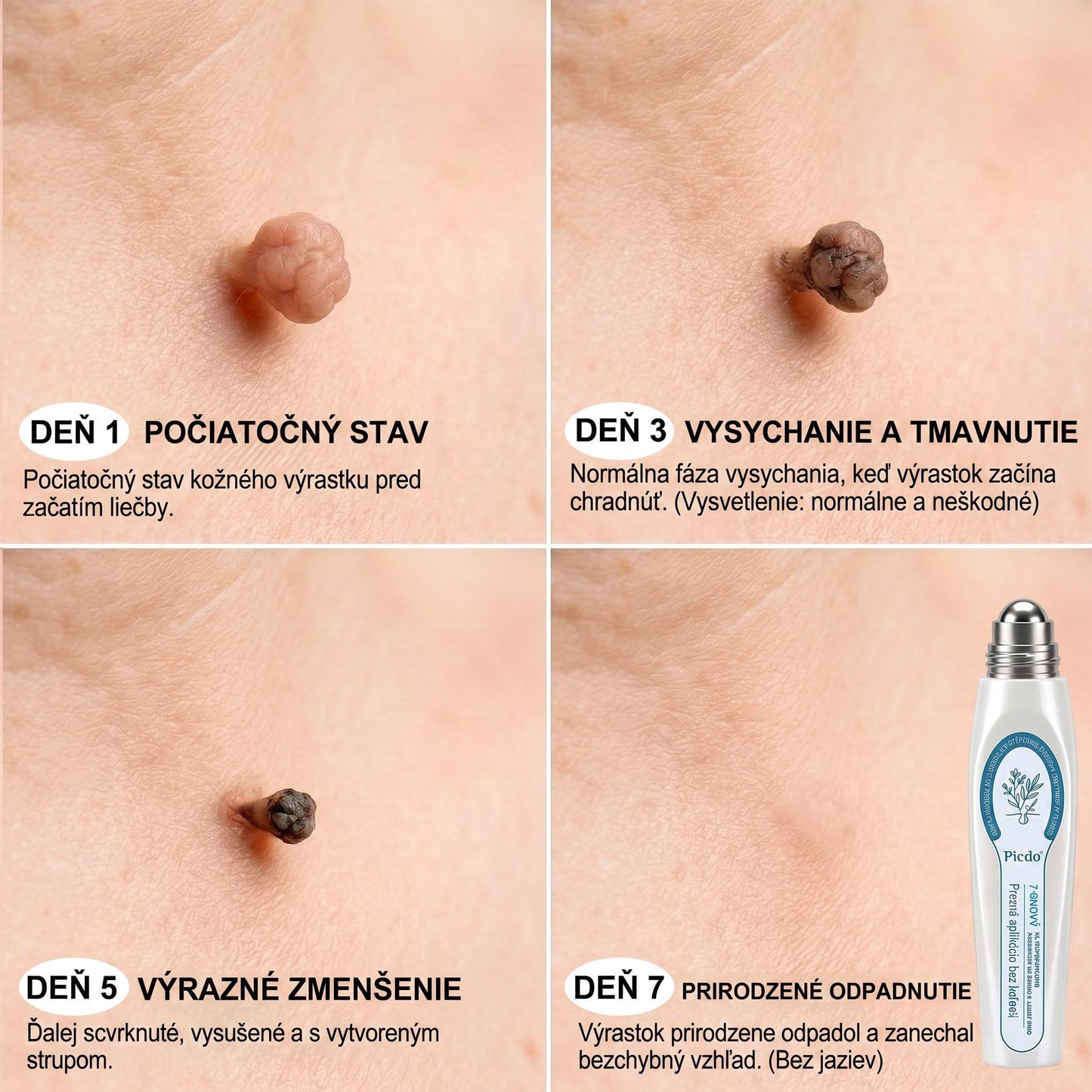 🎁Oficiální obchod | 🌟🌟𝐏𝒊𝐜𝐝𝒐® 7-𝑫ň𝒐𝒗ý 𝑵𝒂 𝑶𝒅𝒔𝒕𝒓𝒂ň𝒐𝒗𝒂𝒏𝒊𝒆 𝑷𝒊𝒈𝒎𝒆𝒏𝒕𝒐𝒗ý𝒄𝒉 Š𝒌𝒗ŕ𝒏 𝑨 𝑱𝒂𝒛𝒊𝒆𝒗 𝑷𝒆𝒓𝒐💛
