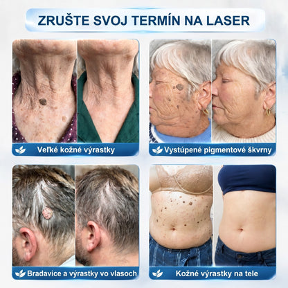 🎁Oficiální obchod | 🌟🌟𝐏𝒊𝐜𝐝𝒐® 7-𝑫ň𝒐𝒗ý 𝑵𝒂 𝑶𝒅𝒔𝒕𝒓𝒂ň𝒐𝒗𝒂𝒏𝒊𝒆 𝑷𝒊𝒈𝒎𝒆𝒏𝒕𝒐𝒗ý𝒄𝒉 Š𝒌𝒗ŕ𝒏 𝑨 𝑱𝒂𝒛𝒊𝒆𝒗 𝑷𝒆𝒓𝒐💛